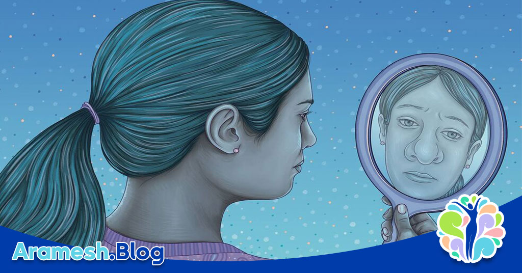 اختلال بای دیسمورفیک: بررسی جامع یک اختلال پیچیده روانی 4 اختلال بای دیسمورفیک: بررسی جامع یک اختلال پیچیده روانی