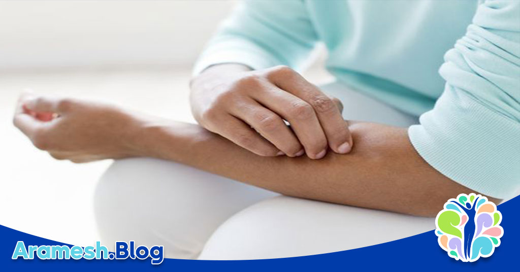 اختلال پوست کنی: شناخت، علل، علائم و درمان 4 اختلال پوست کنی: شناخت، علل، علائم و درمان