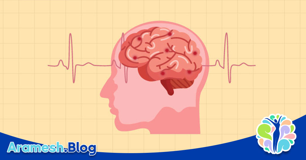جایگاه هیپوکامپ در اختلالات روانی: نقش کلیدی در سلامت روان 5 جایگاه هیپوکامپ در اختلالات روانی: نقش کلیدی در سلامت روان