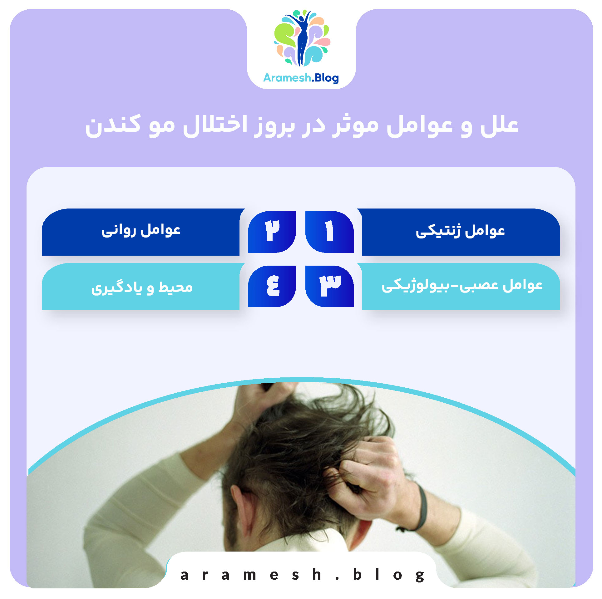 اختلال مو کندن (تریخولومانیا) چیست؟ 3 اختلال مو کندن (تریخولومانیا) چیست؟