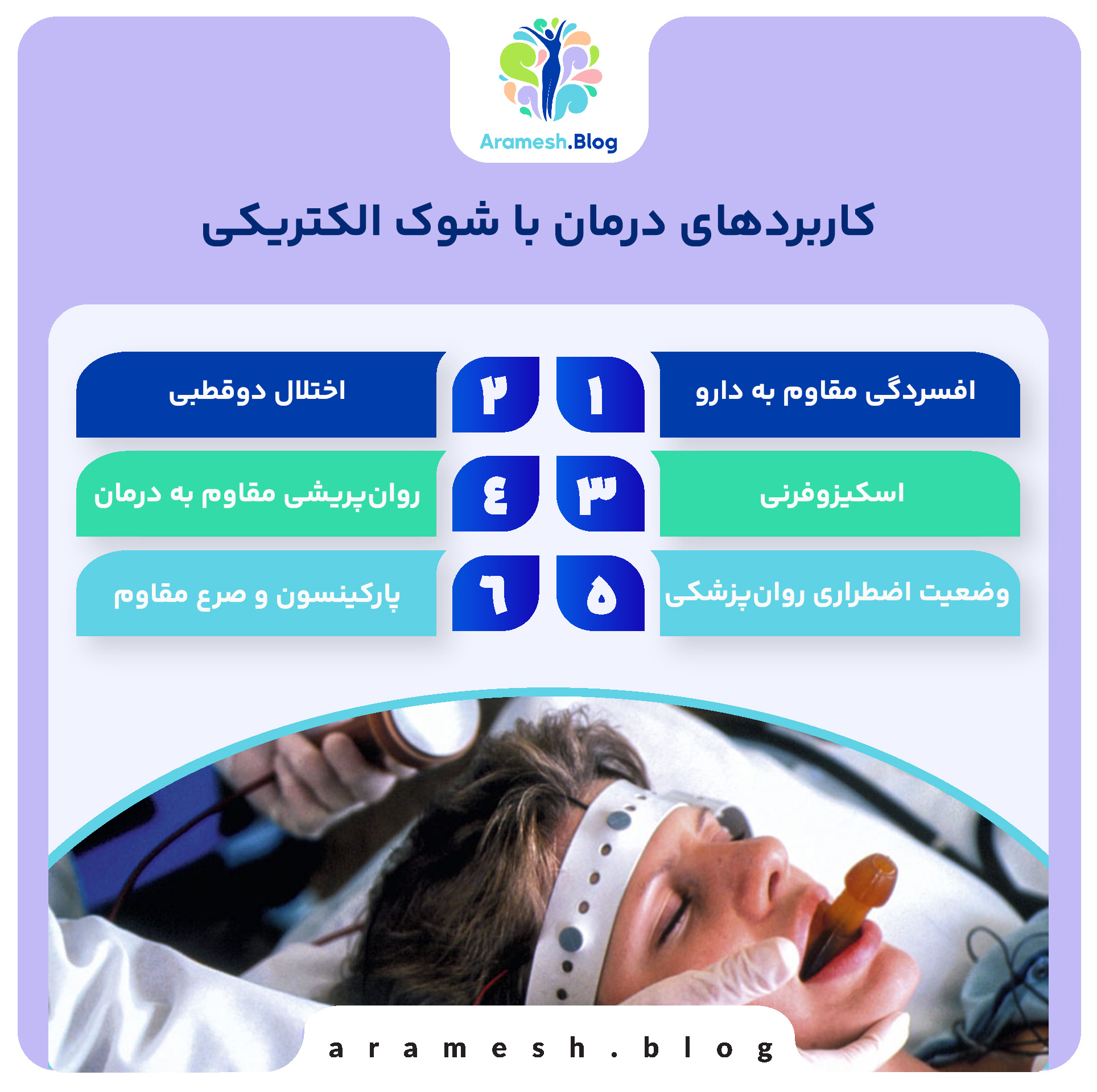 درمان با شوک الکتریکی: تاریخچه، کاربردها، مکانیسم و چالش‌ها