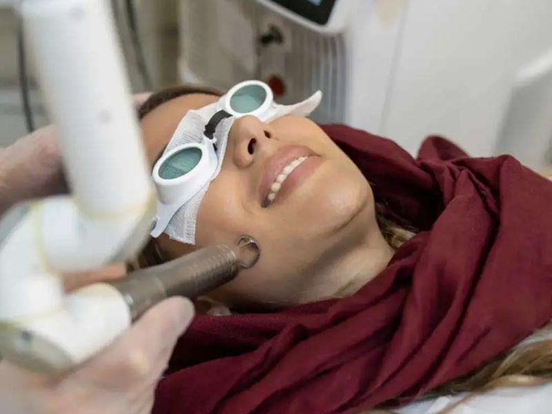 درمان جوش فعال و جای جوش با لیزر فوتونا در مشهد | پکیج کامل کلینیک شاپرک طلایی