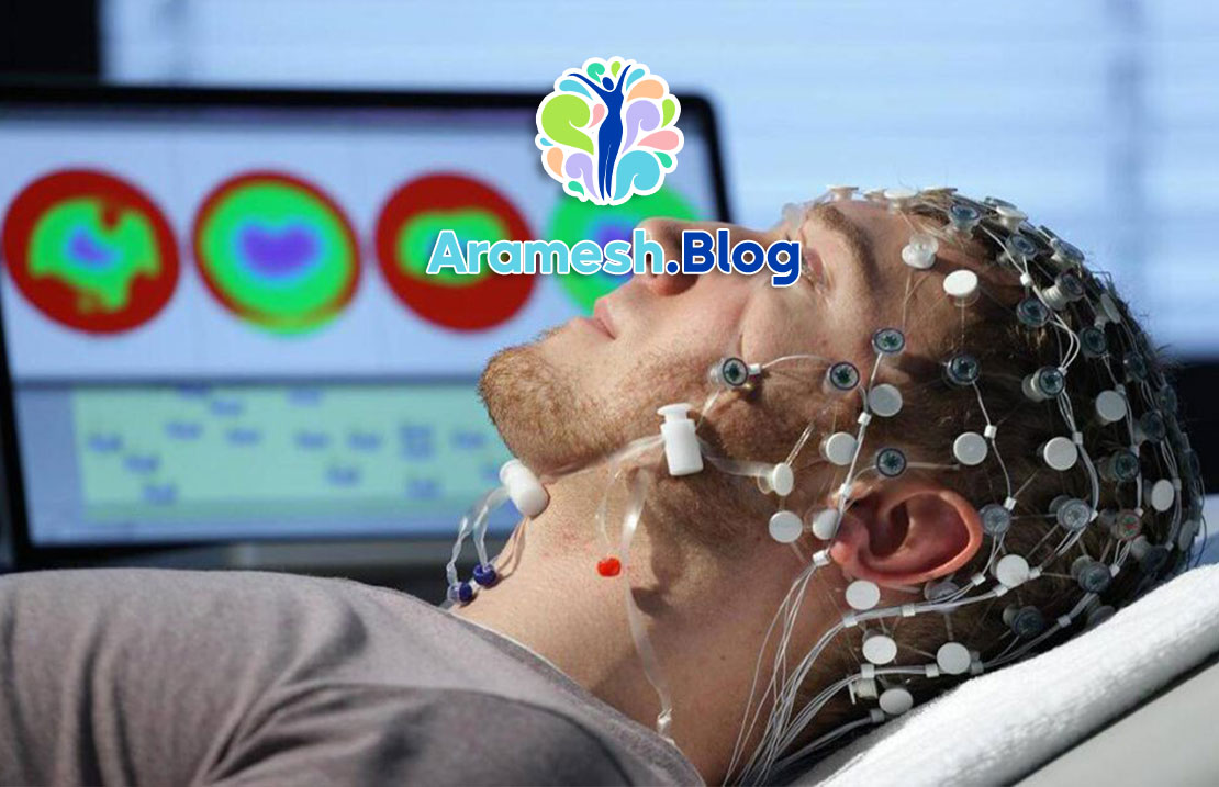 تحلیل ارتباطات عصبی در اختلالات اضطرابی مزمن با EEG 4 تحلیل ارتباطات عصبی در اختلالات اضطرابی مزمن با EEG