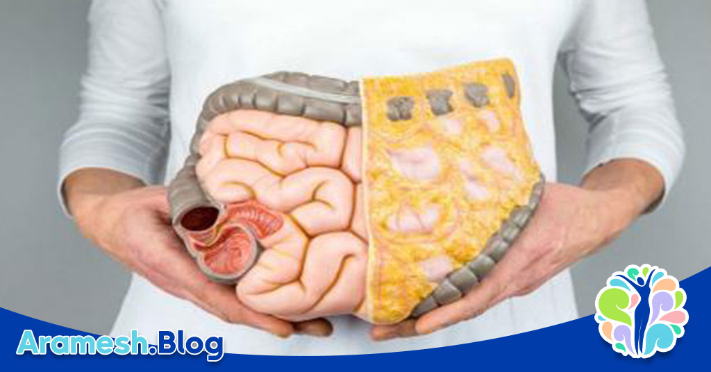 اثرات میکروبیوم روده بر سلامت روان 2 اثرات میکروبیوم روده بر سلامت روان