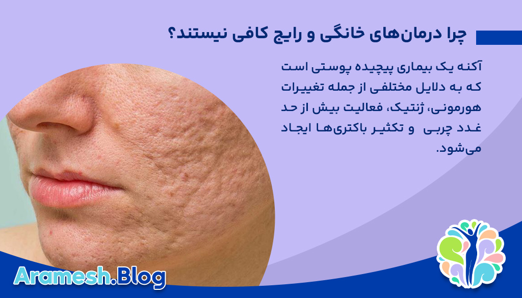 درمان جوش فعال و جای جوش با لیزر فوتونا در مشهد | پکیج کامل کلینیک شاپرک طلایی