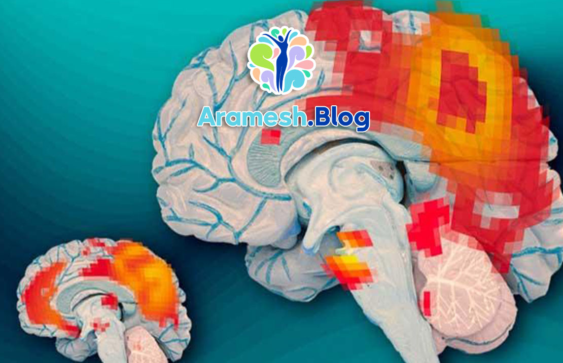 0 تا 100 پردازش هیجانی مغز 1 0 تا 100 پردازش هیجانی مغز