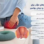 چرا برخی افراد سریع‌تر از هموروئید خلاص می‌شوند؟ رازهای درمان و پیشگیری از عود بیماری